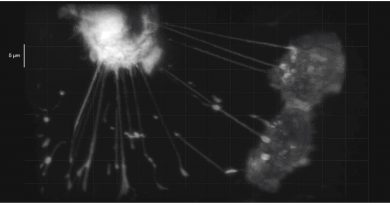 CELLS TALK AND HELP ONE ANOTHER VIA TINY TUBE NETWORKS CELLS TALK AND HELP ONE ANOTHER VIA TINY TUBE NETWORKS